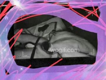 七夕GAY送爆菊花？頭塞屁股肛裂進(jìn)了急診（重口圖）