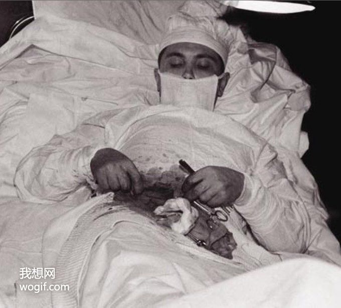 俄羅斯醫(yī)生，給自己做手術切除了闌尾（有圖）